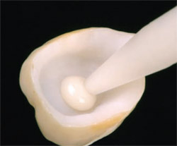 protesi-dentali-cementate