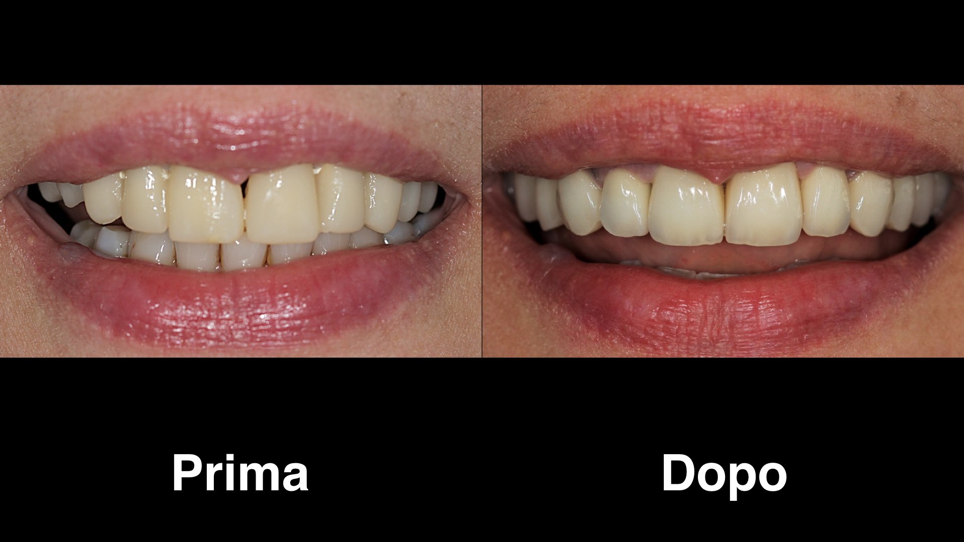 dentisti croazia dentisti croazia