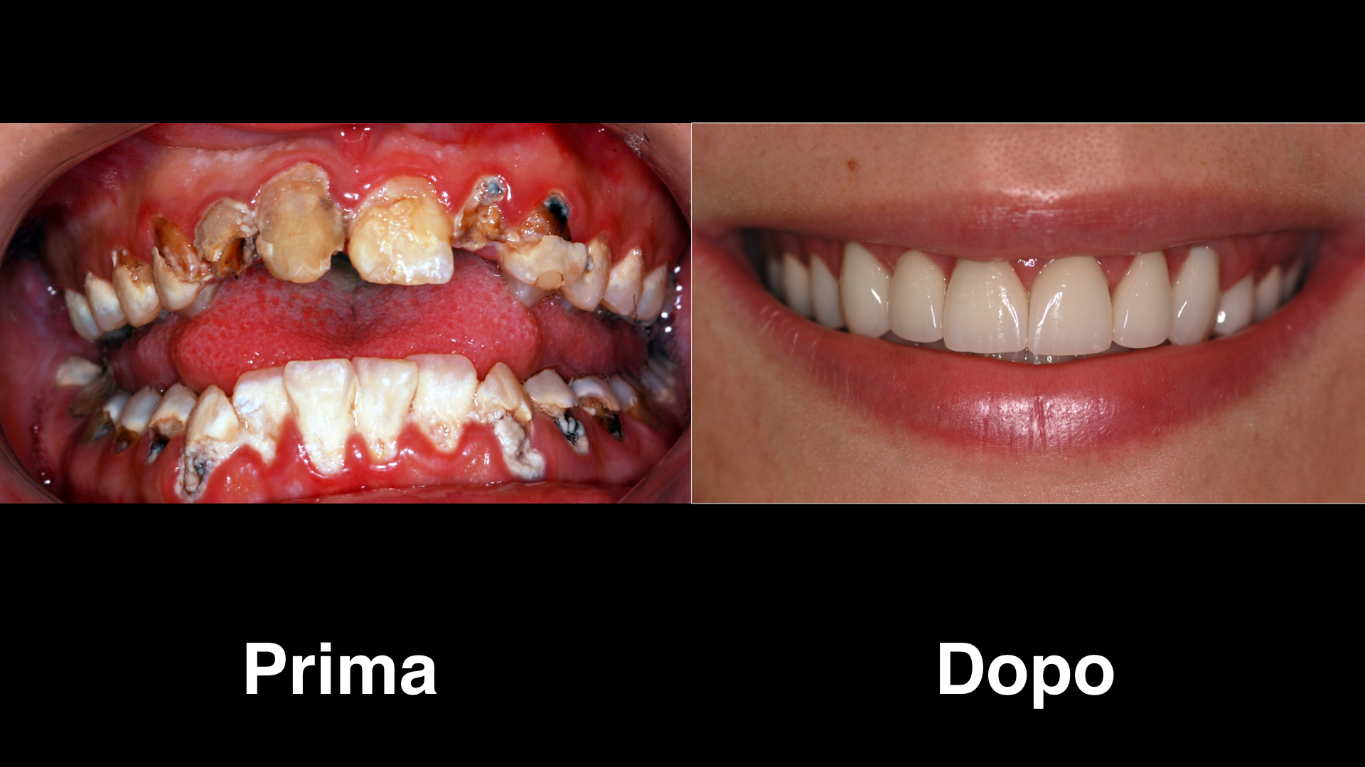 dentisti croazia dentisti-croazia