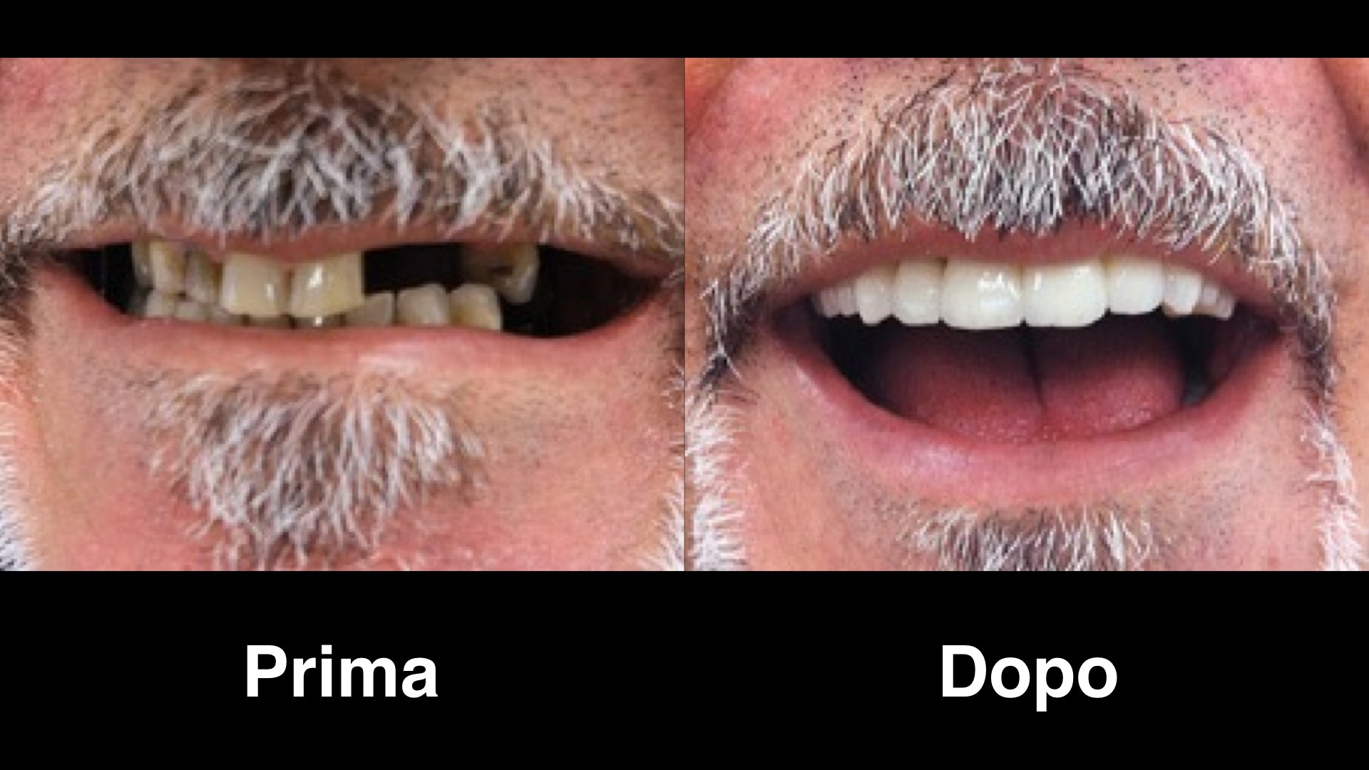 dentisti croazia dentisti-croazia