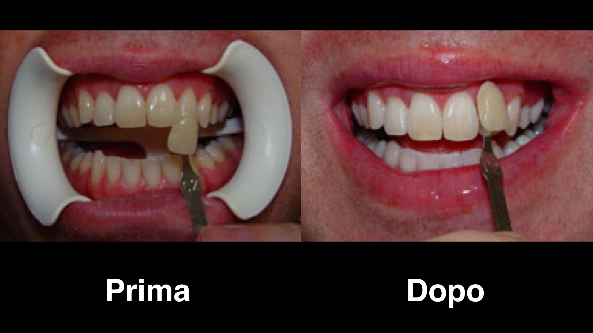 dentisti malta dentisti malta