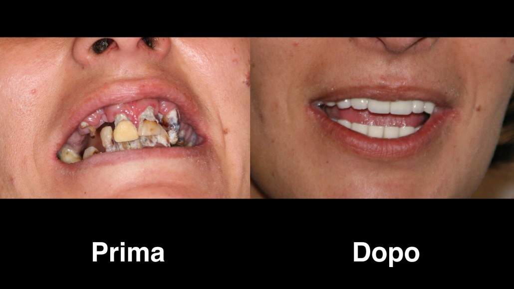 dentisti bulgaria dentisti-bulgaria