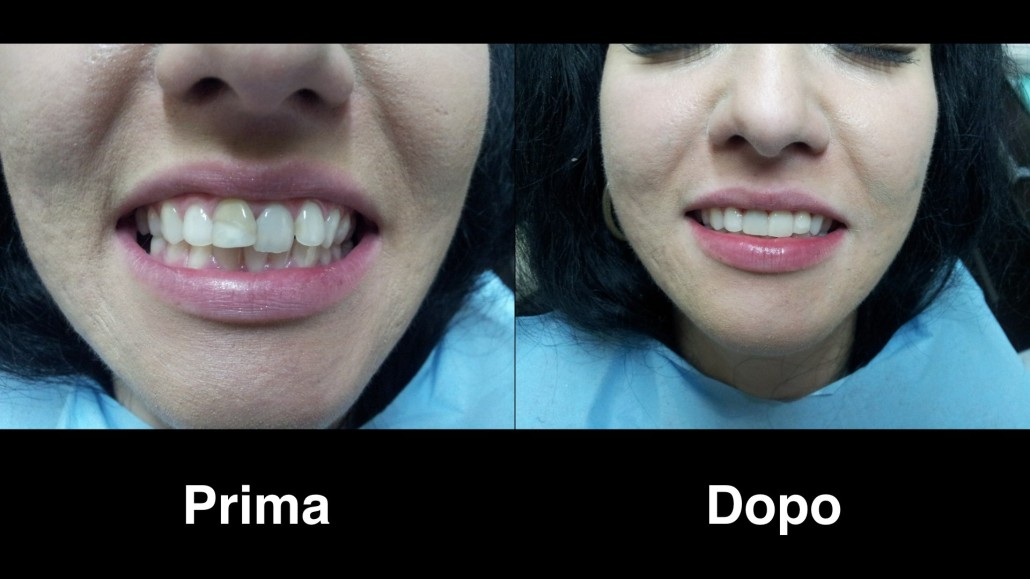 dentisti bulgaria dentisti-bulgaria