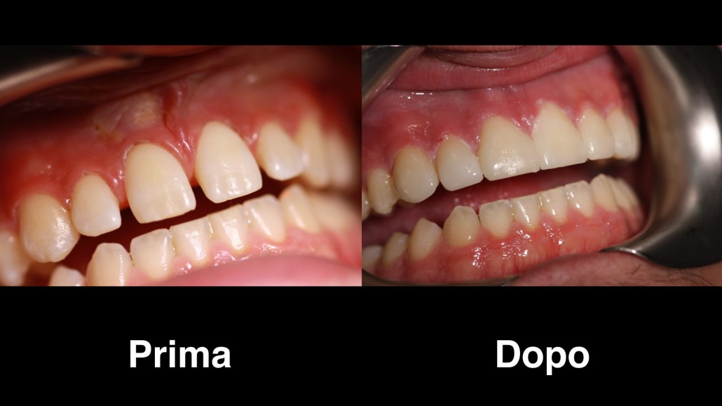 dentisti polonia dentisti polonia