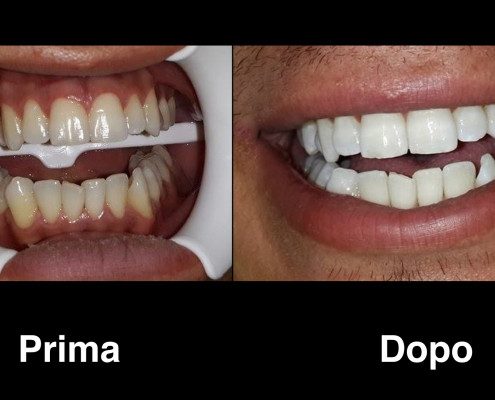 dentisti-albania
