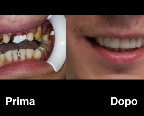 dentisti-albania