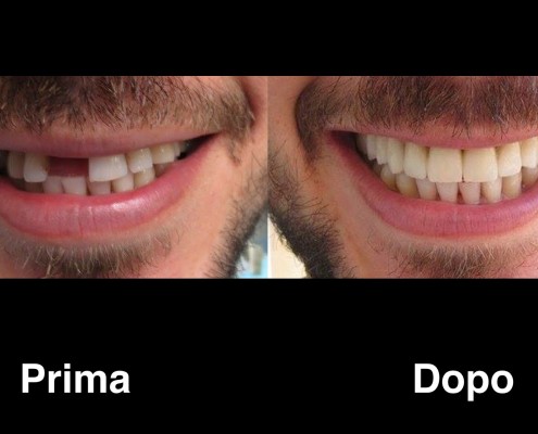 dentisti-albania