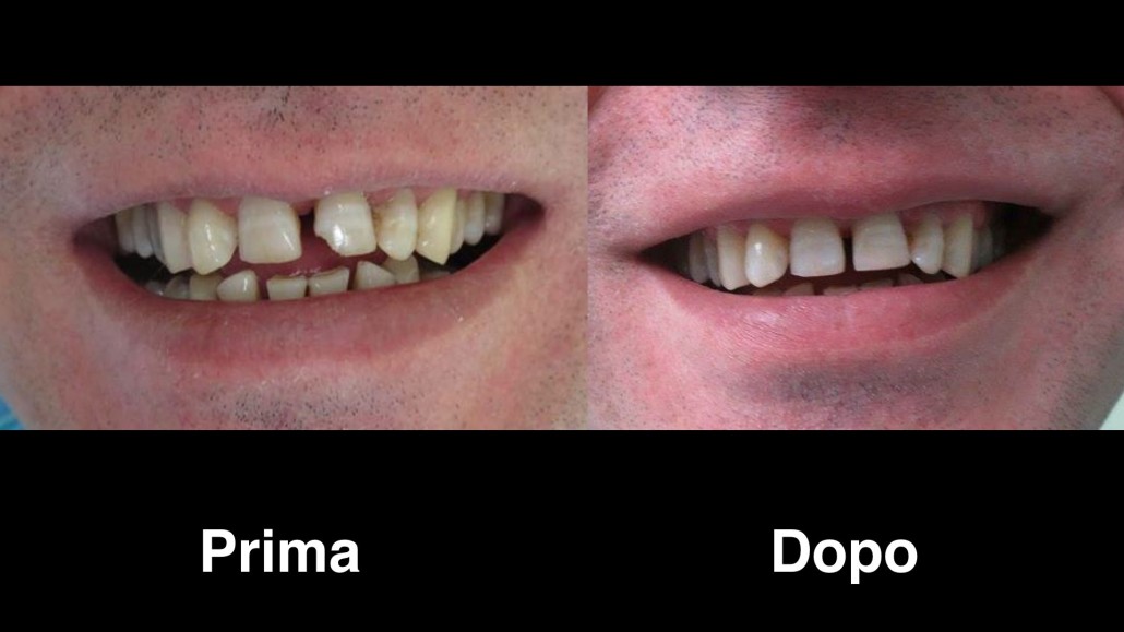 dentisti albania dentisti-albania