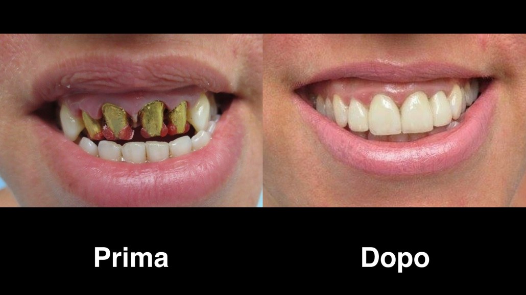 dentisti albania dentisti-albania