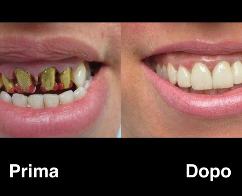 dentisti-albania