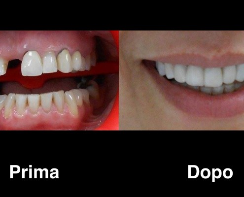 dentisti-albania