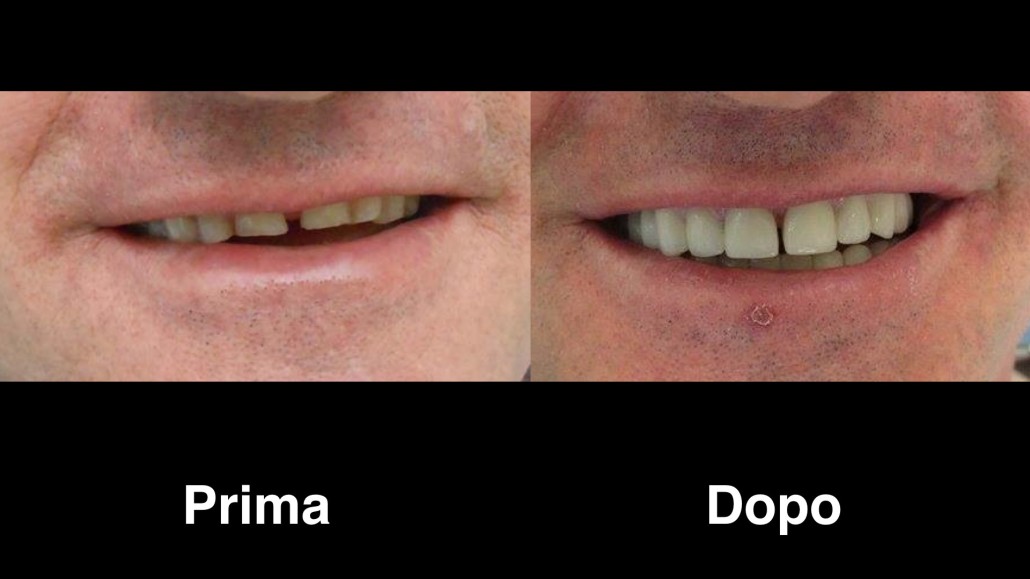 dentisti albania dentisti-albania