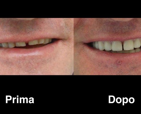 dentisti-albania