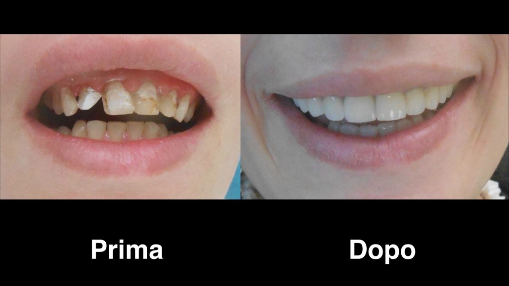 dentisti albania dentisti-albania