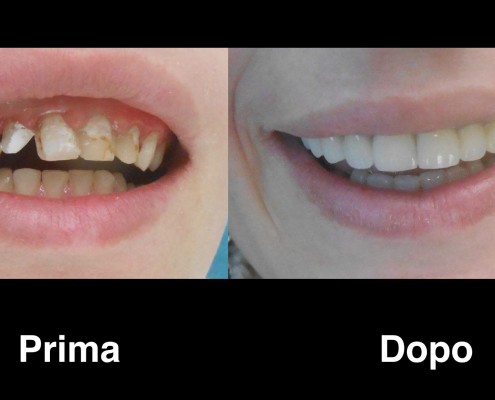 dentisti-albania