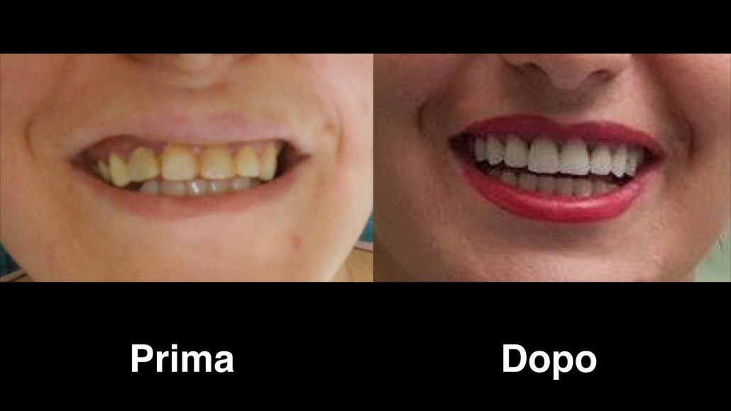 dentisti albania dentisti-albania