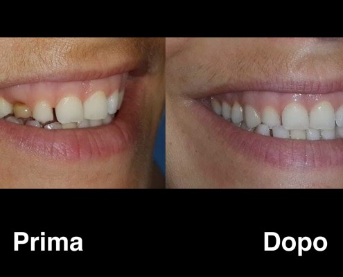 dentisti-albania