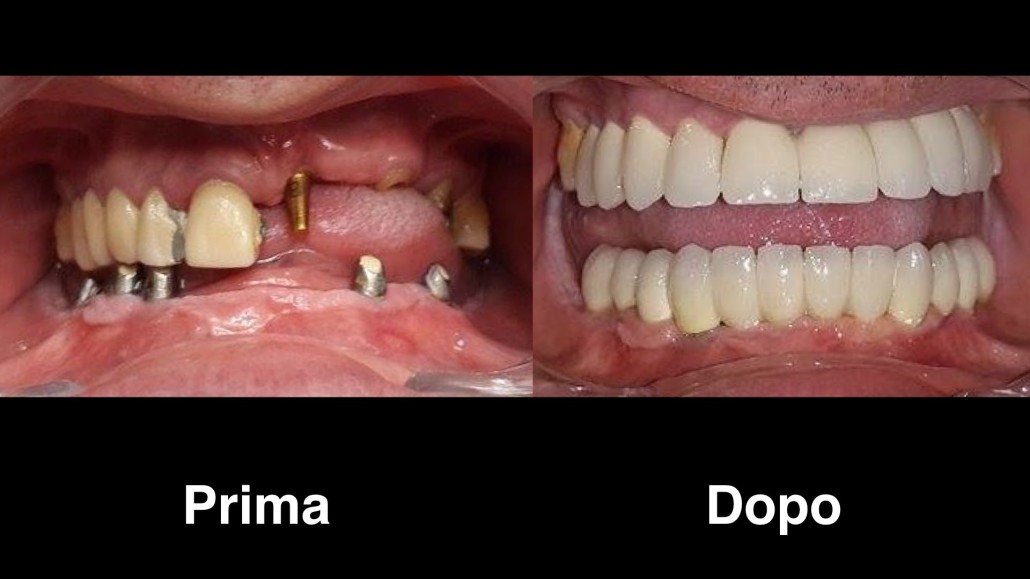 dentisti albania dentisti-albania