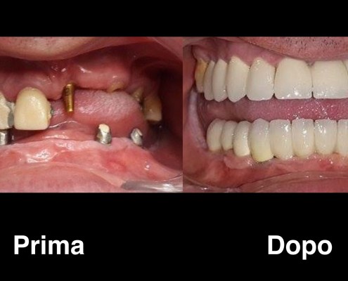 dentisti-albania
