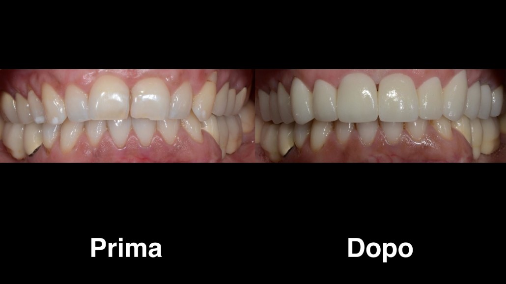 dentisti croazia dentisti-croazia