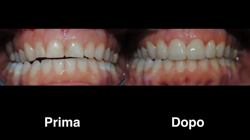 dentisti croazia dentisti-croazia