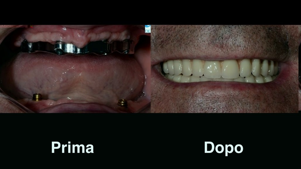 dentisti croazia dentisti-croazia