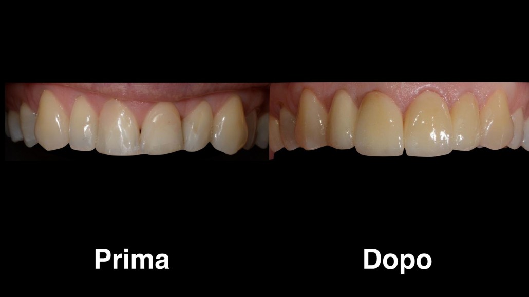 dentisti croazia dentisti-croazia