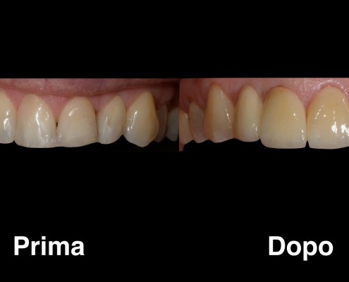dentisti-croazia