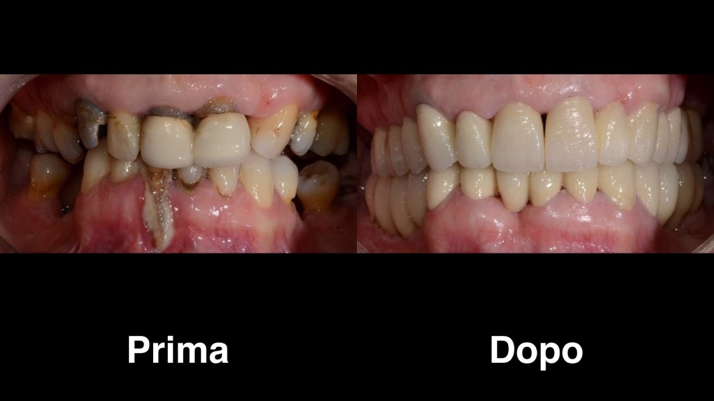 dentisti croazia dentisti-croazia