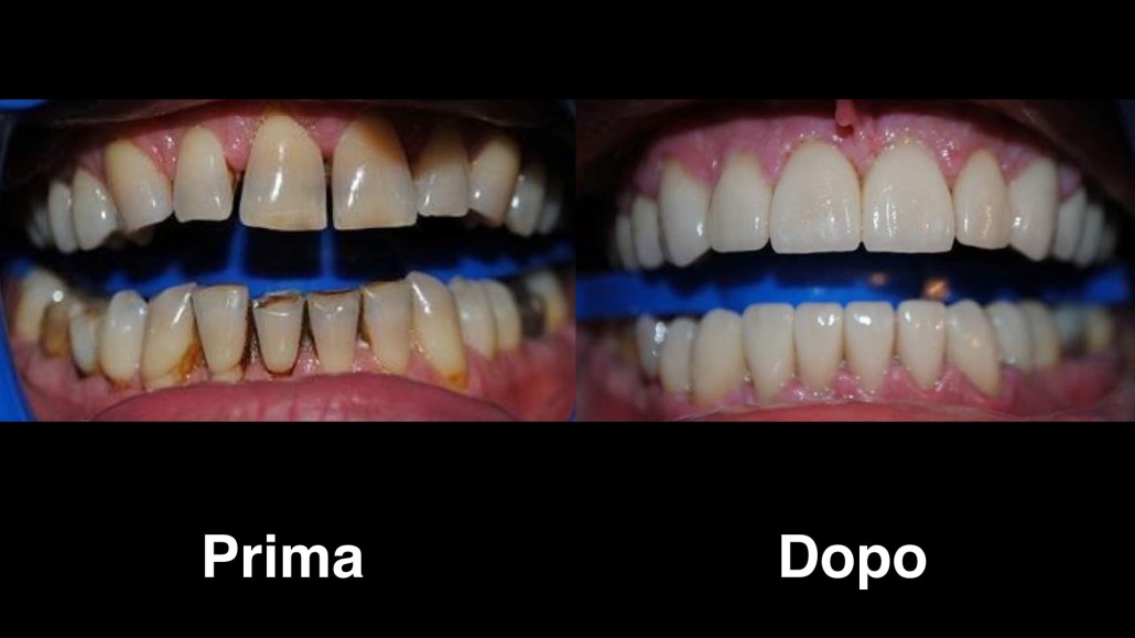 dentisti croazia dentisti-croazia