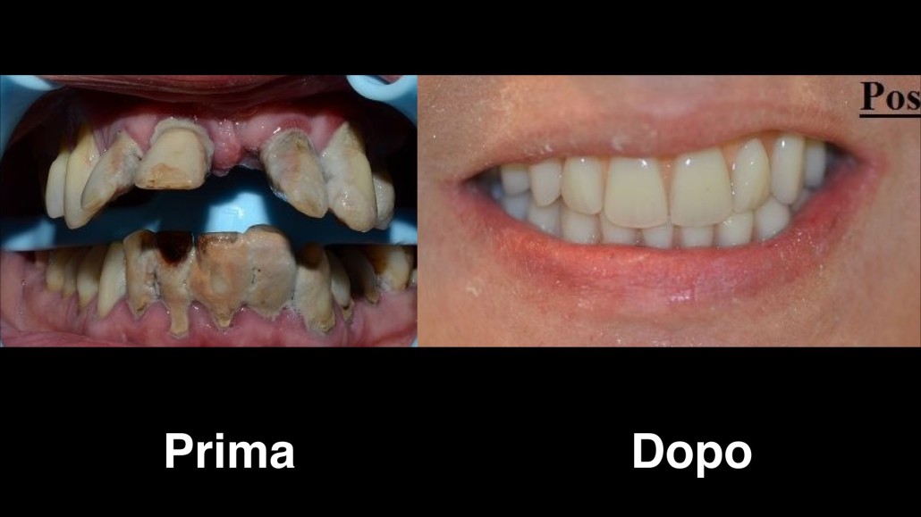 dentisti croazia dentisti-croazia
