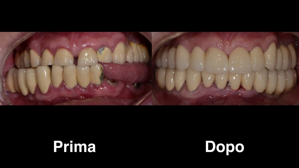 dentisti croazia dentisti-croazia