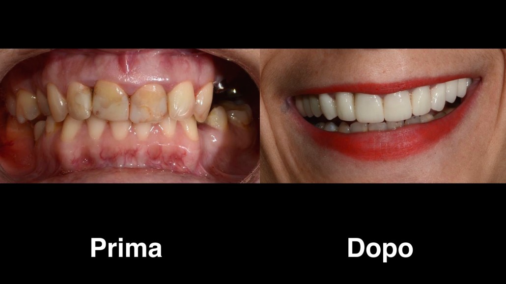 dentisti croazia dentisti-croazia