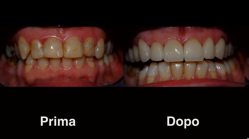 dentisti croazia dentisti-croazia