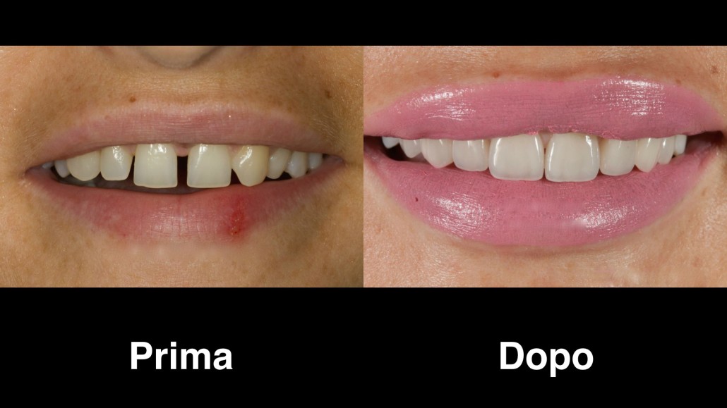 dentisti romania dentisti-romania