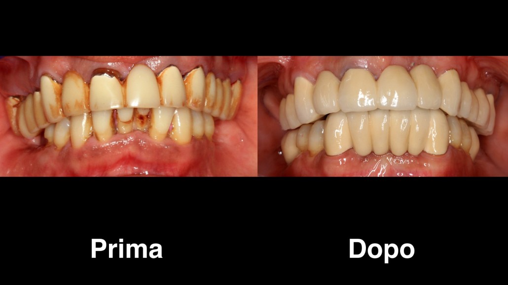 dentisti romania dentisti-romania
