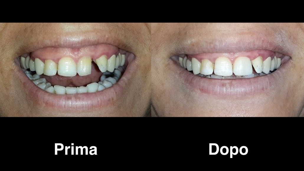 dentisti albania dentisti-albania