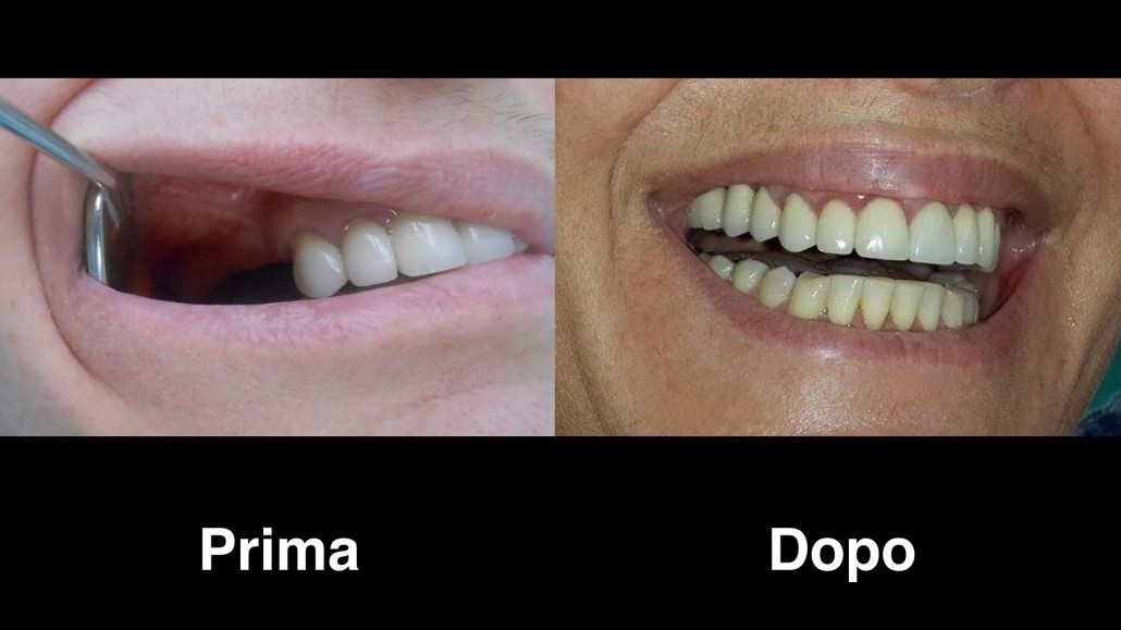dentisti albania dentisti-albania