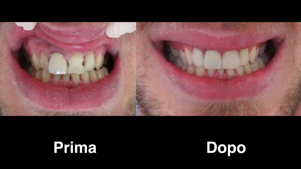 dentisti albania dentisi-albania