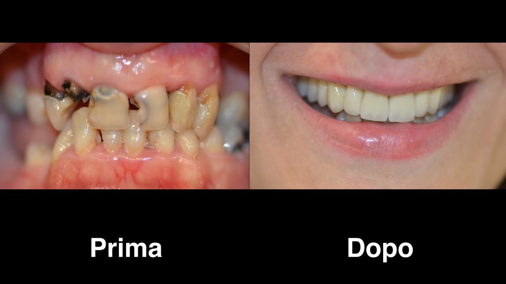 dentisti croazia dentisti-croazia