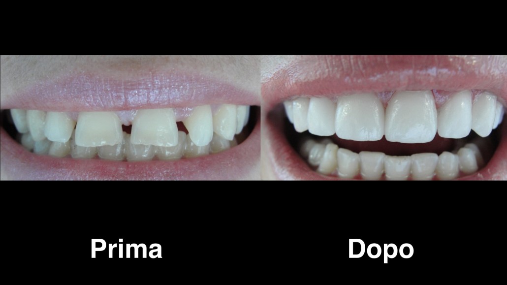 dentisti albania dentisti-albania