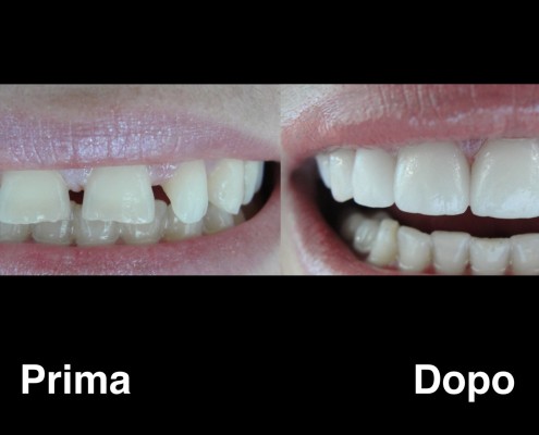 dentisti-albania
