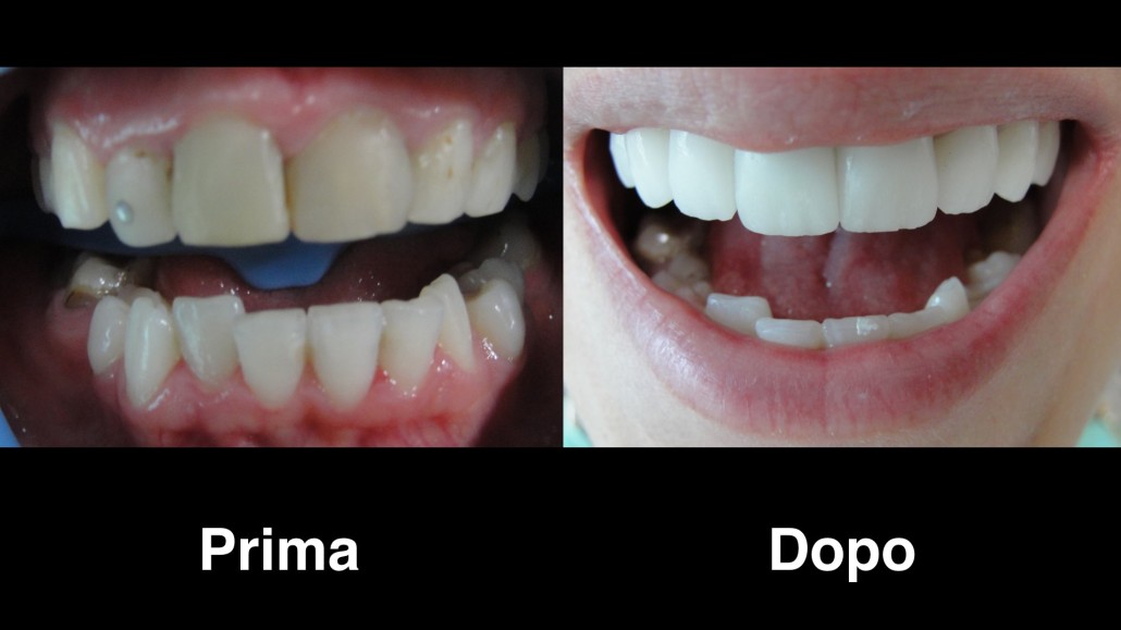 dentisti albania dentisti-albania
