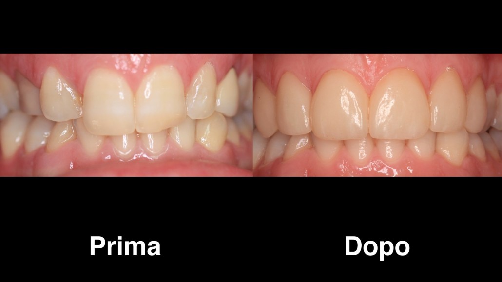 dentisti croazia dentisti-croazia
