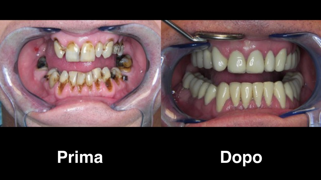 dentisti budapest dentisti-budapest