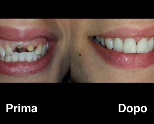 dentisti-albania