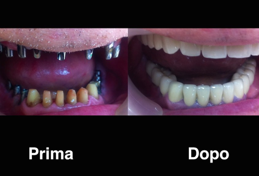 dentisti moldavia dentisti-moldavia
