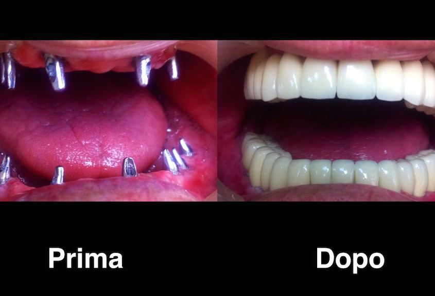 dentisti moldavia dentisti-moldavia