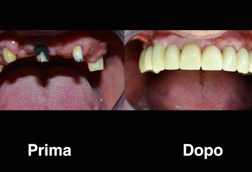 dentisti moldavia dentisti-moldavia