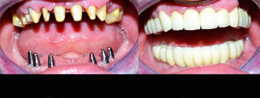 dentisti moldavia dentisti-moldavia